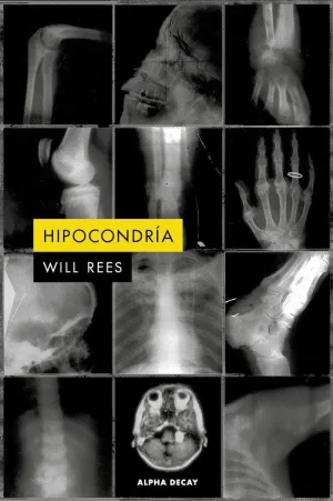 HIPOCONDRÍA